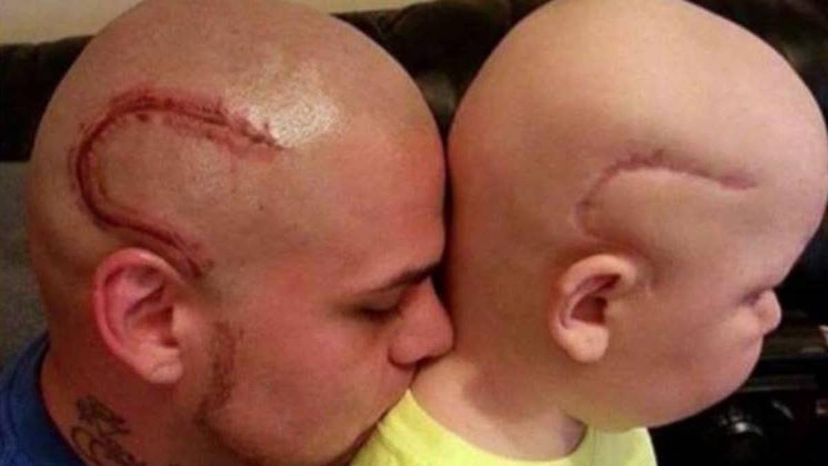 Dad tattoos scar on head to honor son battling brain cancer